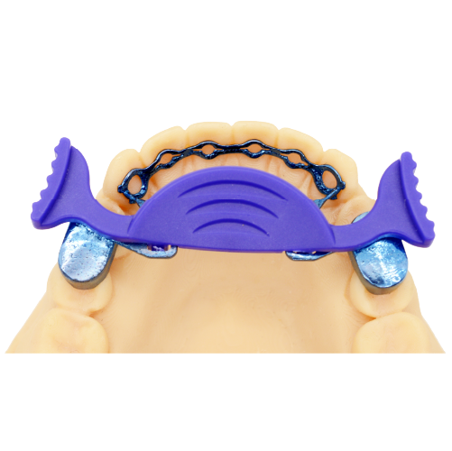 Infinity Fixed Lingual Retainer TMO(Lower)