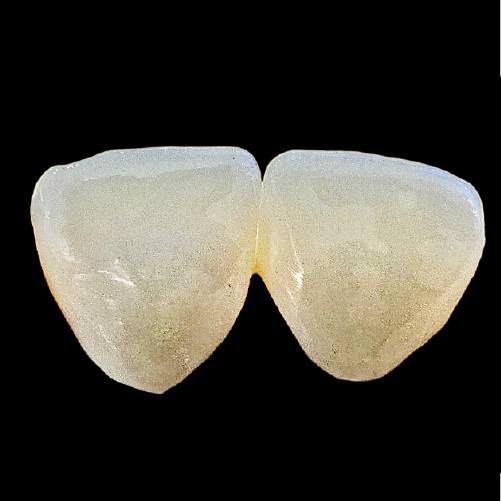 Zirconia