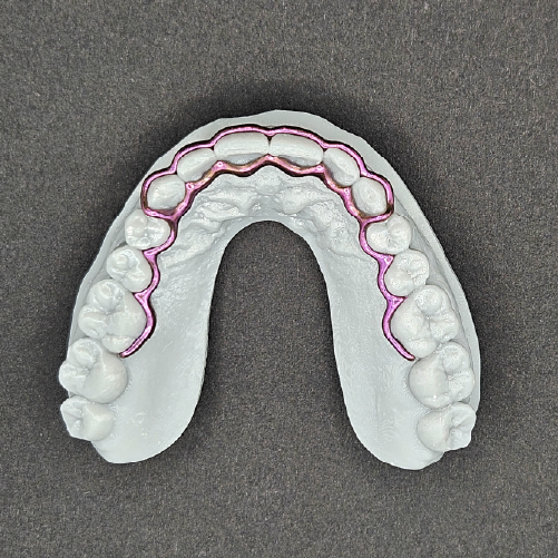 Atlas Retainer
