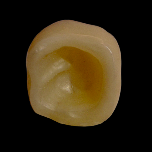 FMZ1