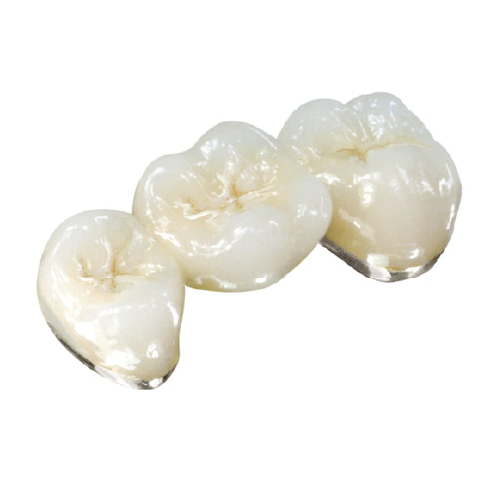 PFM Bridge High White