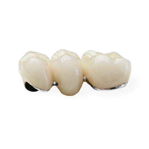 PFM High White