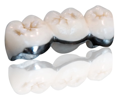 PFM_Semi_Crown