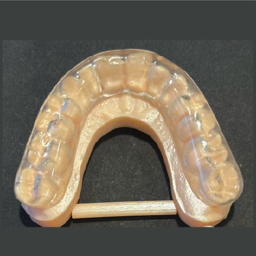 Soft splint