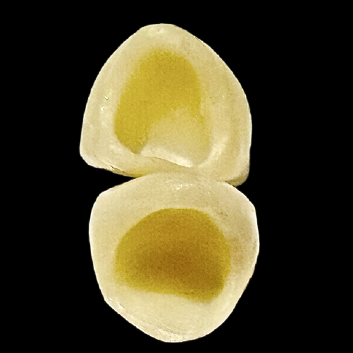 e.max 2